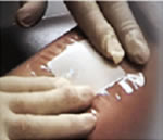 OxyBand wound care devices will be available in a number of sizes for your emergency care needs.